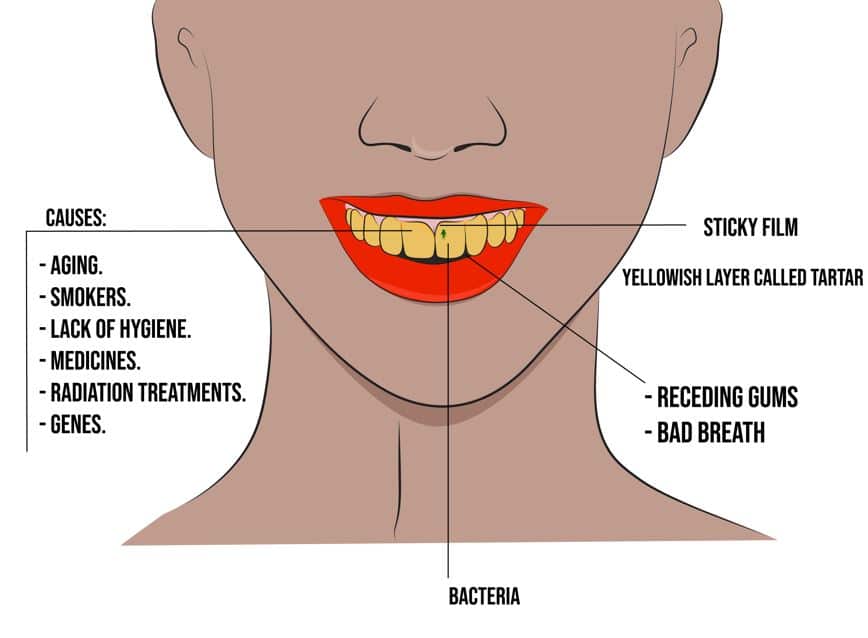 Factor Contributing To Yellow Teeth